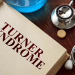 TURNER SYNDROME