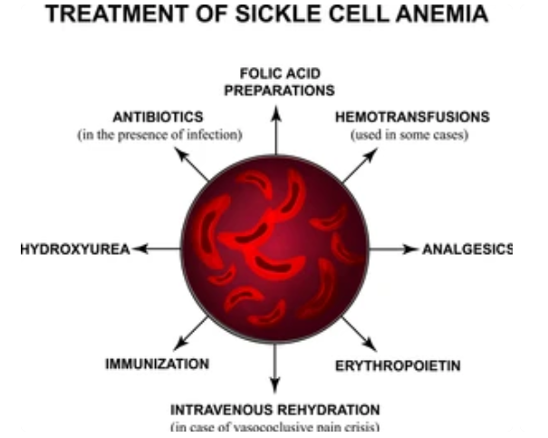 SICKLE CELL ANEMIA