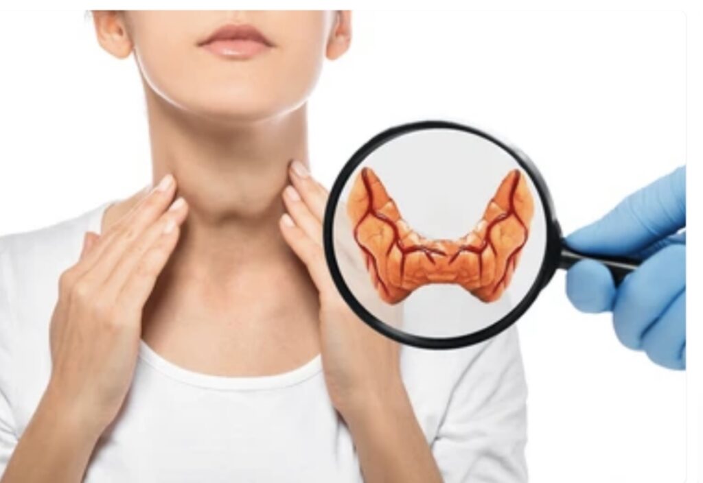 HYPOTHYROIDISM