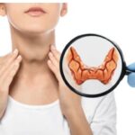 HYPOTHYROIDISM