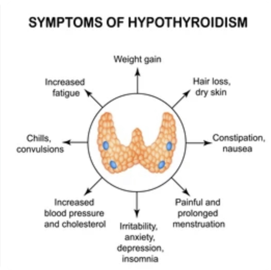 HYPOTHYROIDISM