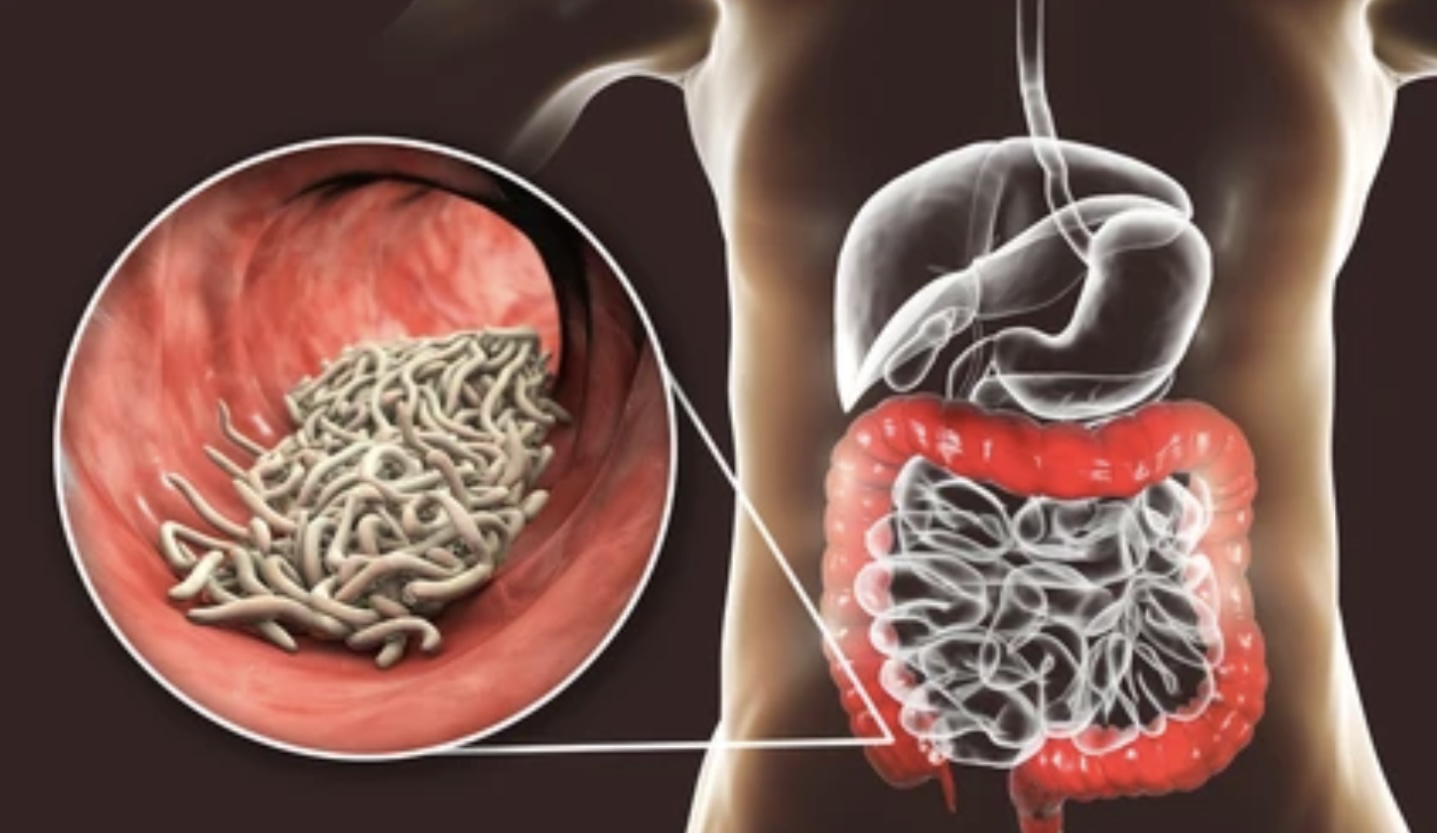 Read more about the article ASCARIASIS AND ITS VECTOR