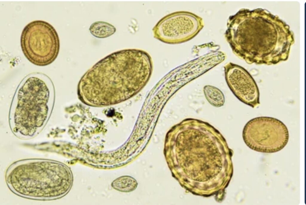 DISEASES CAUSED BY HELMINTHS