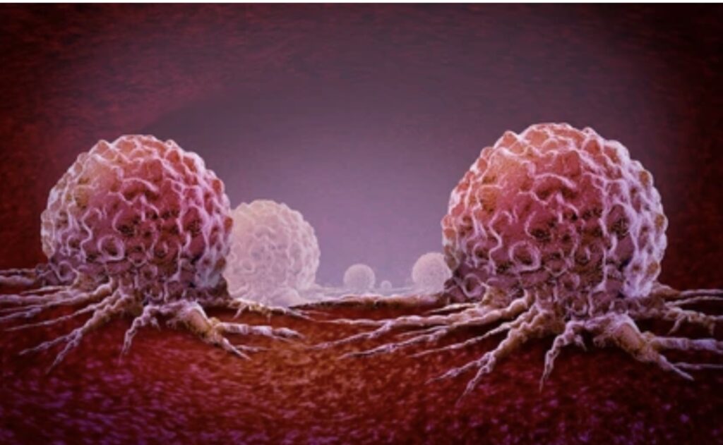 UNDERSTANDING TUMOURS: CAUSES, TYPES AND DIAGNOSIS