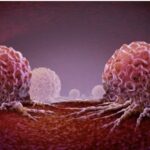 UNDERSTANDING TUMOURS: CAUSES, TYPES AND DIAGNOSIS