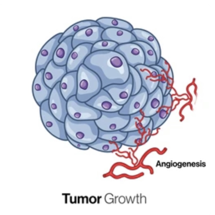 UNDERSTANDING TUMOURS: CAUSES, TYPES AND DIAGNOSIS