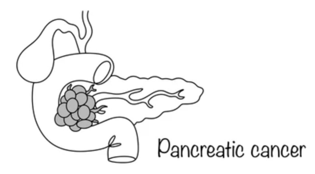 PANCREATIC GLAND